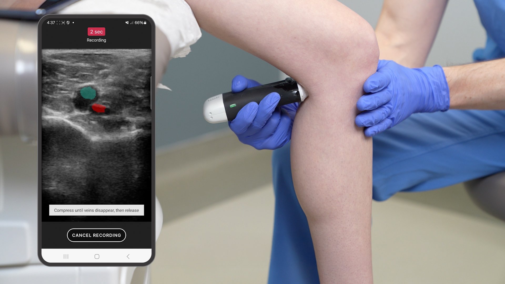 Ultrasound Training Video